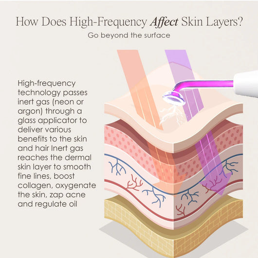 High-Frequency Skin Therapy Wand Kit